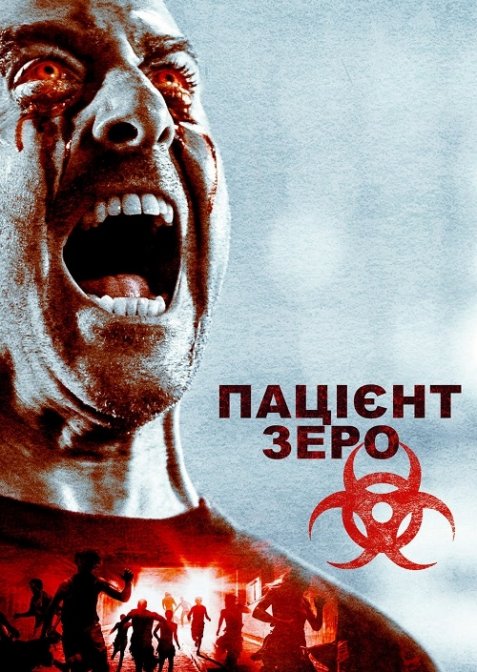 Пацієнт Зеро